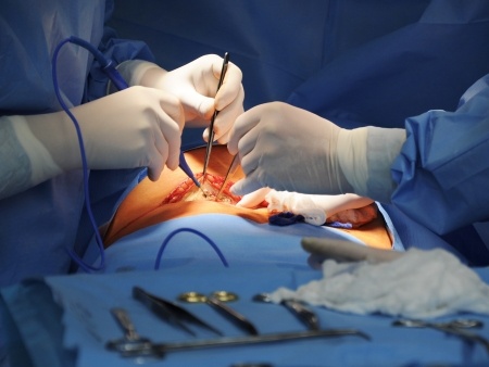 Medical Malpractice Surgical Injuries